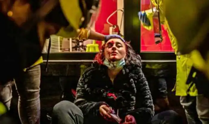 Imagen de la mujer herida en el ojo presuntamente por un disparo de los Mossos durante las protestas en Barcelona por el encarcelamiento de Pablo Hasél Ángel García